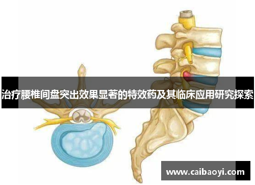 治疗腰椎间盘突出效果显著的特效药及其临床应用研究探索